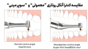 قیمت روتاری دوکاره وودپیکر قیمت Endo Smart Pro اپکس لوکیتور داخلی اندو اسمارت پرو اپکس روتاری اندو اسمارت پرو وودپیکر Woodpecker Endo Smart Pro - قیمت خرید اندو روتاری دوکاره اندو اسمارت پرو وودپیکر Woodpecker Endo Smart Pro - هد آنگل روتاری اندو اسمارت پرو وودپیکر
